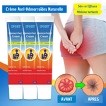 Creme Naturel Anti-Hémorroïdes